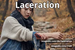 laceration