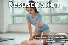 resuscitation