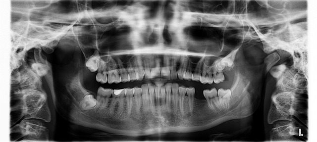 tooth